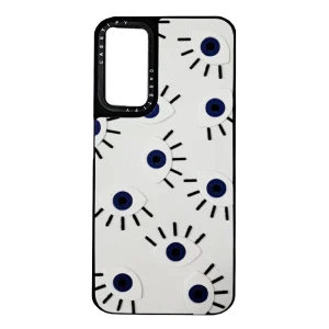 قاب شیائومی Casetify Eyes XIAOMI Note13 Pro 5G